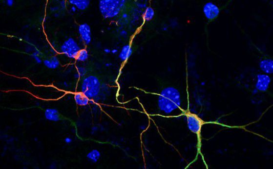 Химическа обработка трансформира кожни клетки в неврони