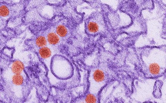 Първото ясно доказателство за връзка между вируса Зика и микроцефалията