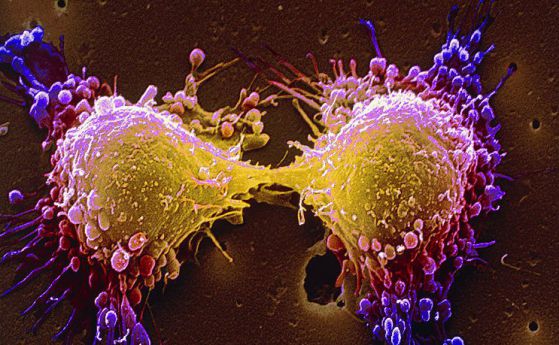Нов безвреден метод за лечение чрез изтощаване на раковите клетки