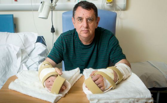 Трансплантация на две ръце извършиха за първи път във Великобритания