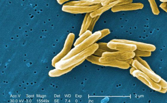 Туберкулозната бактерия