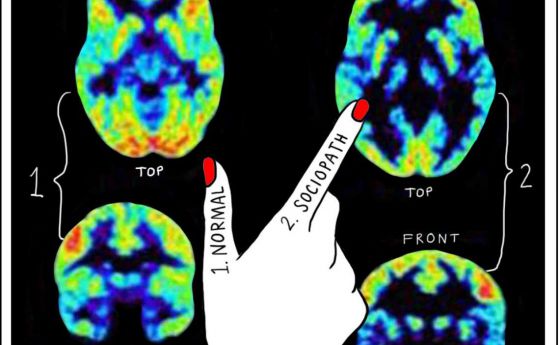 Престъпните наклонности може да се разкрият чрез сканиране на мозъка