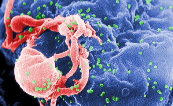 Организмът на момиче от ЮАР напълно потисна ХИВ инфекцията си