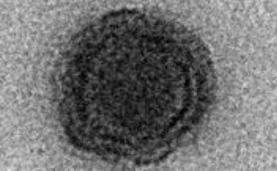 Учените откриха загадъчен вирус без познати гени, които могат да идентифицират