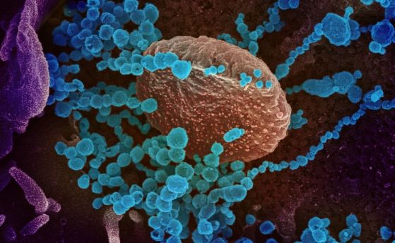 Коронавирусът може да атакува имунната система като ХИВ