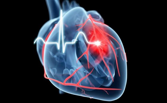 Опасен парадокс: Физическата активност може да ускори натрупването на рискови фактори за инфаркт