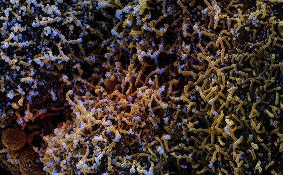 Аутопсии на белите дробове на починали от COVID-19 разкрива как се разпространява и уврежда белодробната тъкан вирусът SARS-CoV-2