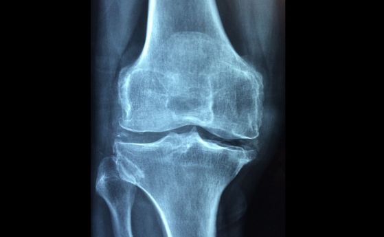 Ново лечение значително намалява болката в коляното без операция
