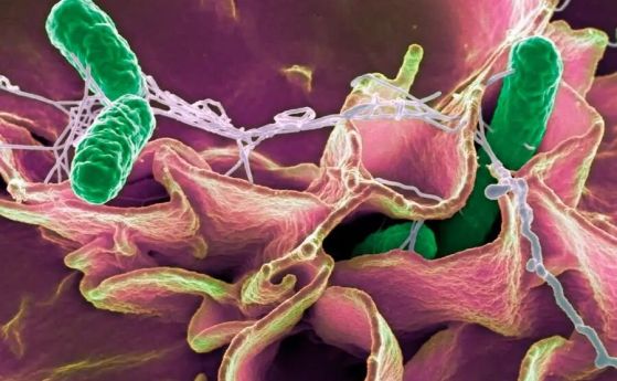 Бактерия Salmonella (зелено), цветна сканираща електронна микрография (SEM). Бактериите Salmonella могат да причинят хранително отравяне, когато се консумират в заразена храна. Симптомите включват коремна болка, гадене, диария и повръщане. Увеличение: x87