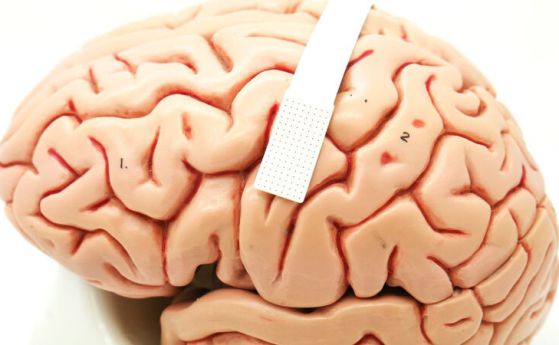 Учени създадоха и тестваха мозъчен имплант за общуване само с мисли