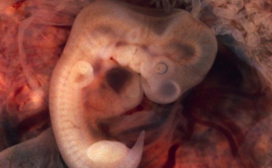 човешки ембрион