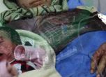 Бебе се роди в Сирия с шрапнел, забит в челото