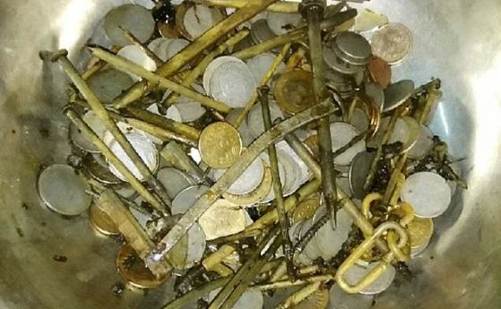Индийски хирурзи извадиха 263 монети 100 пирона ножчета за бръснене