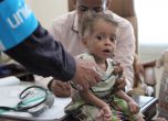 Войната в Йемен тласка страната към глад с катастрофален мащаб