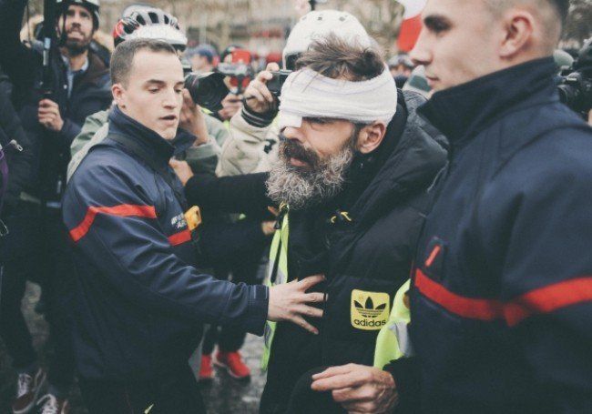 Лидерът на жълтите жилетки Жером Родригес бе тежко ранен на 11-ия съботен