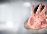 Над 2000 заразени с морбили в Украйна за седмица, болните са вече над 35 000