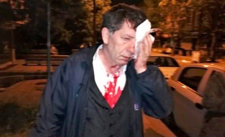 Известен турски журналист е бил нападнат и бит с бейзболни