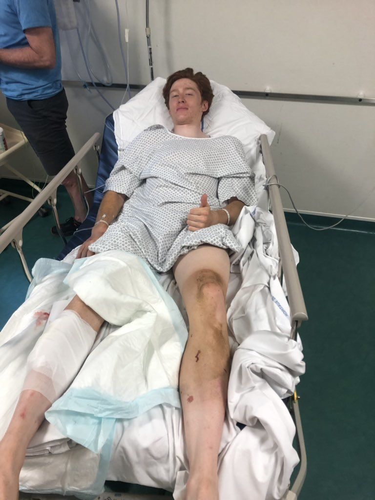 Страховита травма получи младият американски колоездач Матео Йоргенсон по време
