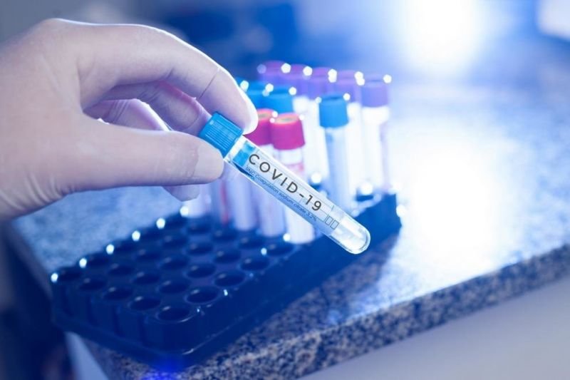 142 са новодиагностицираните с COVID 19 лица през последното денонощие PCR тестовете