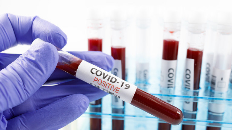 Румъния разхлабва мерките, наложени заради пандемията от новия коронавирус. От