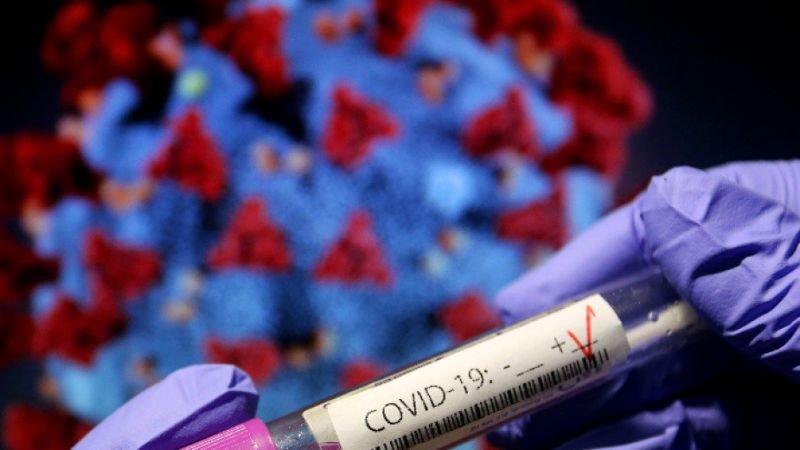 39 са новите случаи на коронавирус, потвърдени при направени 1