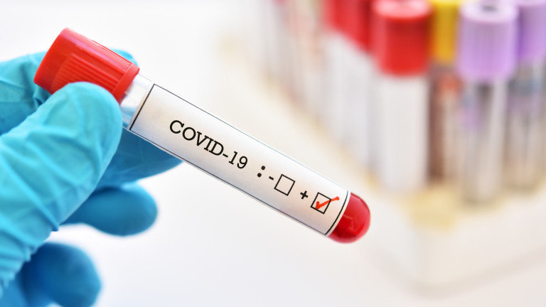 154 са новите случаи на COVID-19, установени при направени 5