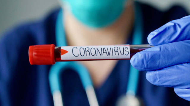 587 са новите случаи на коронавирус потвърдени при направени 4