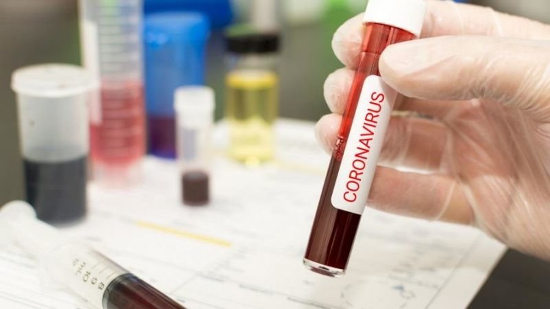 Схема за издаване на фалшиви отрицателни PCR тестове за COVID 19
