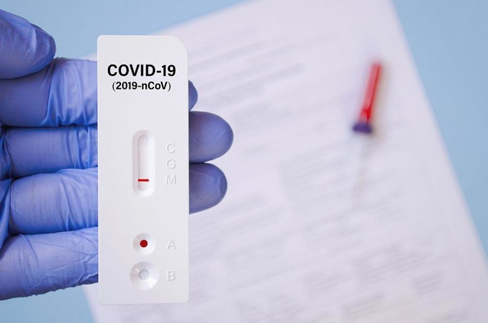 От днес антигенните тестове за установяване на COVID 19 се приравняват