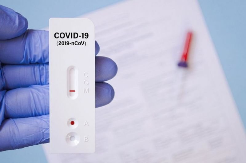 1615 са новите случаи на коронавирус при направени 6945 теста