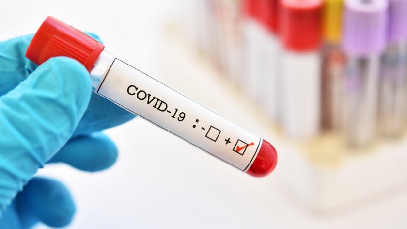 782 са новозаразените с коронавирус е нас за последното денонощие