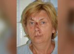 Полицията установи коя е жената с амнезия от остров Крък