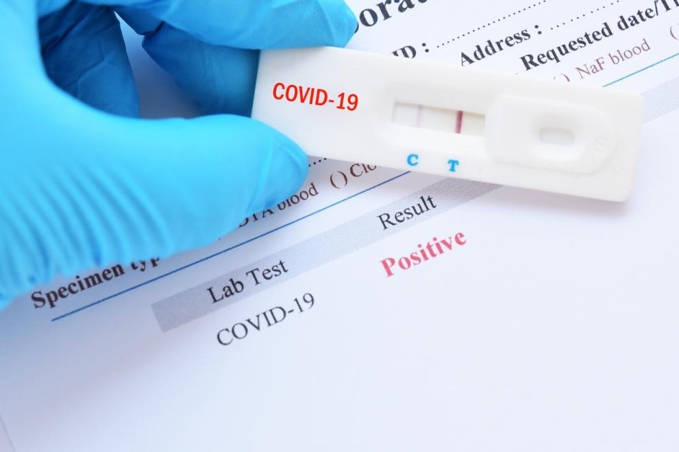 2426 са новите случаи на коронавирус потвърдени при направени 35 004