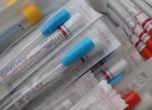 Делтакрон - нов вариант на коронавируса открит в Кипър