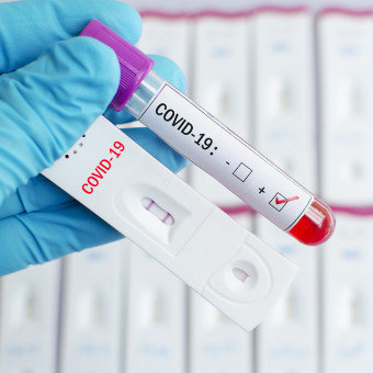 Всички преболедували COVID, доказано с бърз антигенен тест, изследвани на