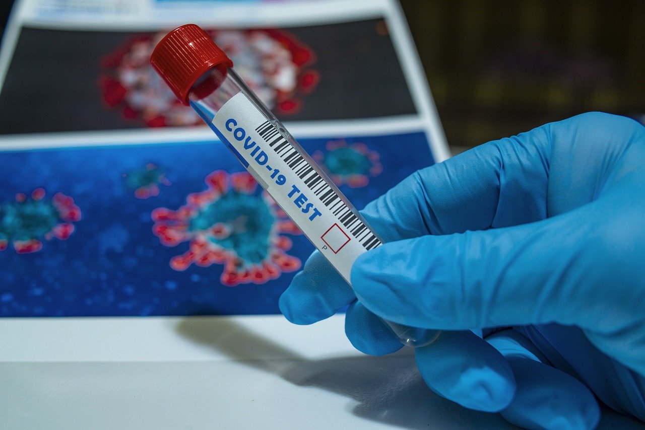 523 са новите случаи на коронавирус потвърдени при направени 4 881