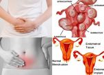 Ендометриоза: Една от 10 жени в репродуктивна възраст се среща с болестта