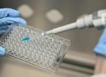Лаборатория: Всеки пети PCR тест за коклюш е положителен