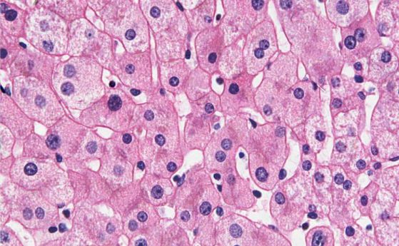 Новооткрити клетки възстановяват черния дроб, без риск от рак