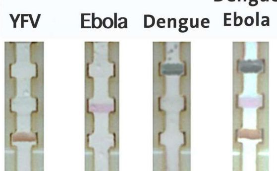 Измислиха как да се диагностицира ебола без лабораторни тестове