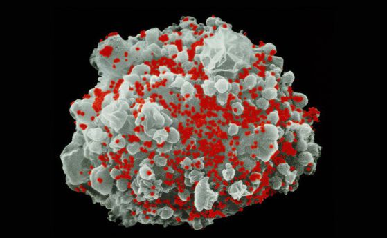 ХИВ вируса може да убива клетки чрез директен контакт между тях