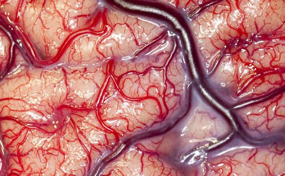 Само една капка кръв в мозъка може да предизвика автоимунна атака