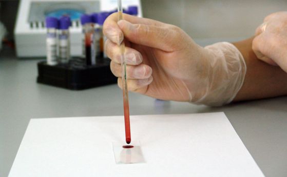 Кръвен тест определя биологичната възраст