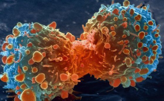 Защо раковите клетки предпочитат да добиват енергия от ферментация?