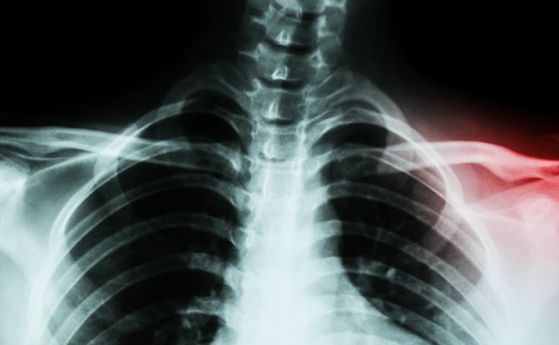Костите ни могат да се възстановяват много по-бързо благодарение на нанообвивки