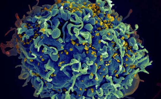 Генетични "ножици" могат да елиминират веднъж и завинаги ХИВ-вируса от клетките