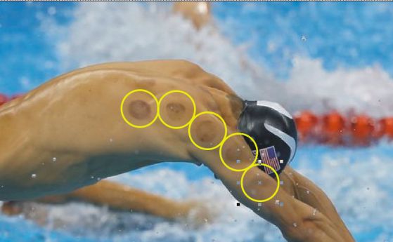Плувецът Майкъл Фелпс употребява вендузи. Какво казва науката за тях? (видео)