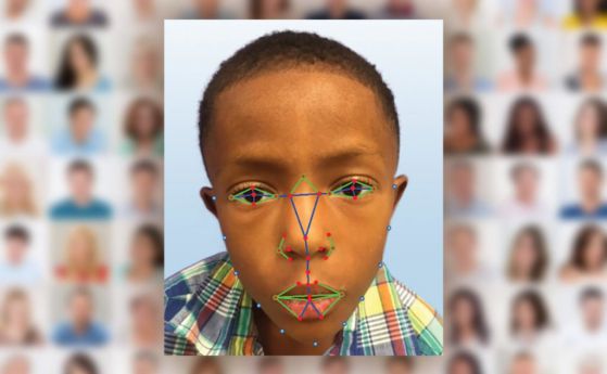 Софтуер за лицево разпознаване успешно диагностицира рядка генетична болест