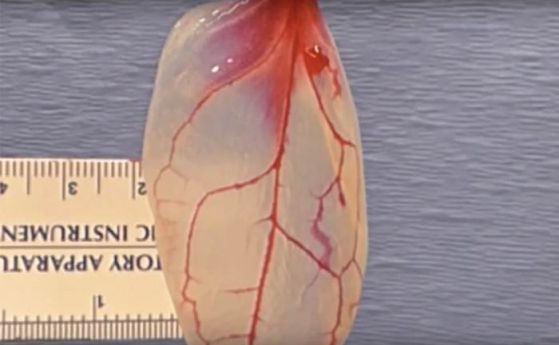 Превърнаха листа на спанак в тъкан на сърдечен мускул (видео)