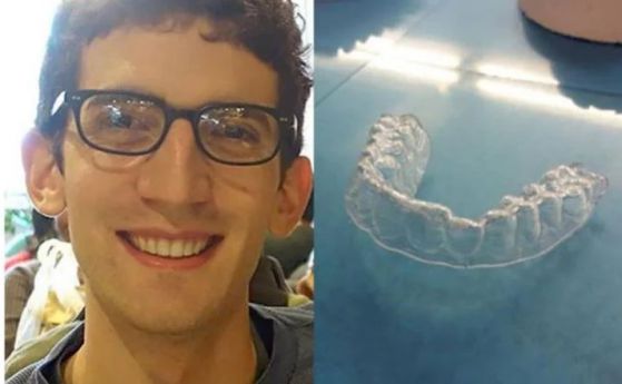 Колежанин принтира на 3D собствените си зъбни шини